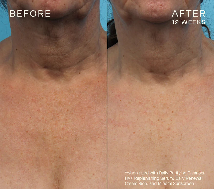 Advanced Regenerative Serum 15mL