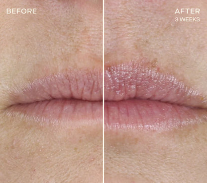 The Lip Plumping and Enhancing Regimen