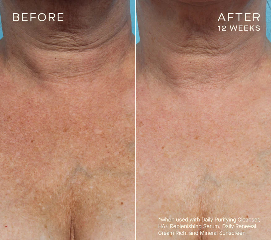 Advanced Regenerative Serum 30mL
