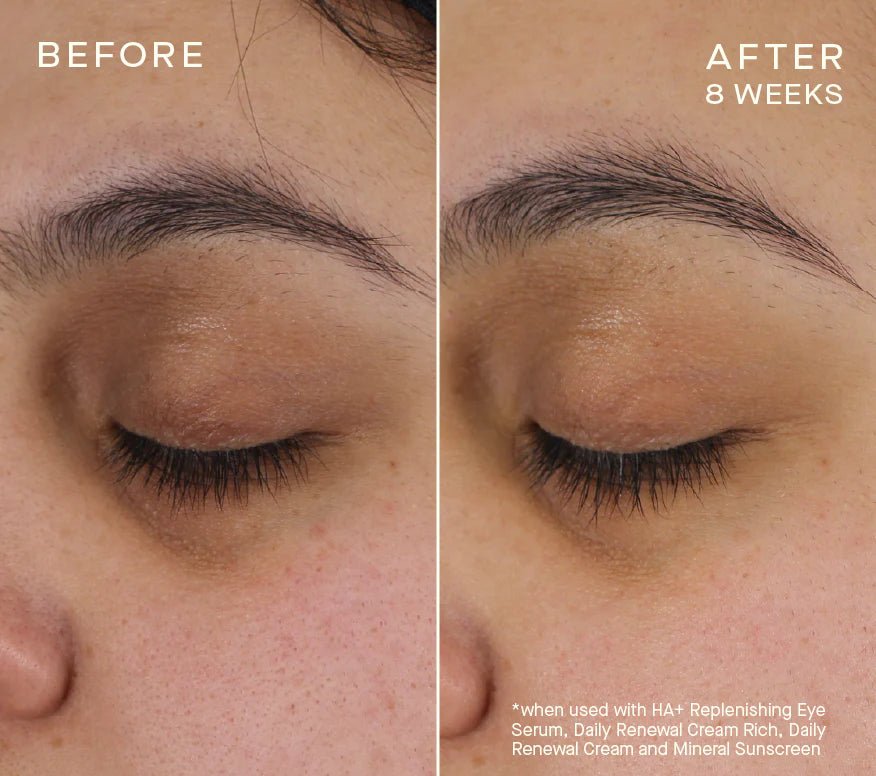 Advanced Regenerative Eye Serum
