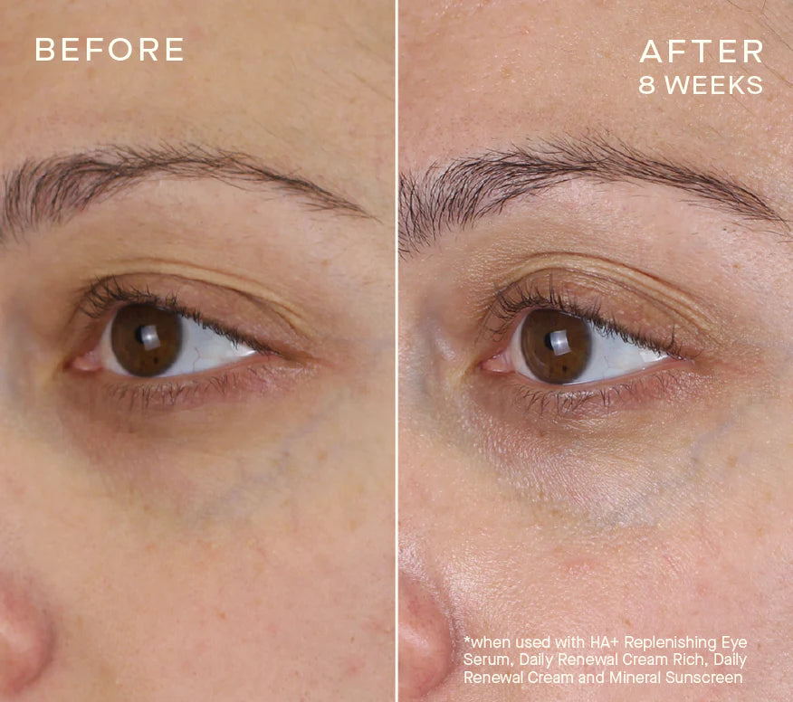 Advanced Regenerative Eye Serum