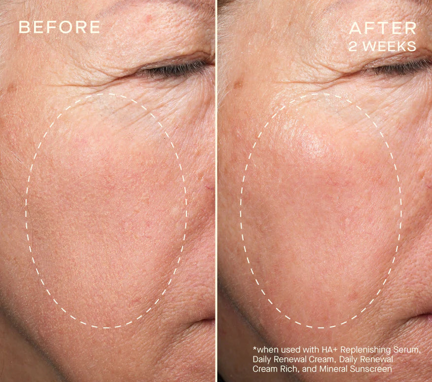 Advanced Regenerative Serum 30mL