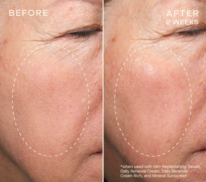 Advanced Regenerative Serum 30mL