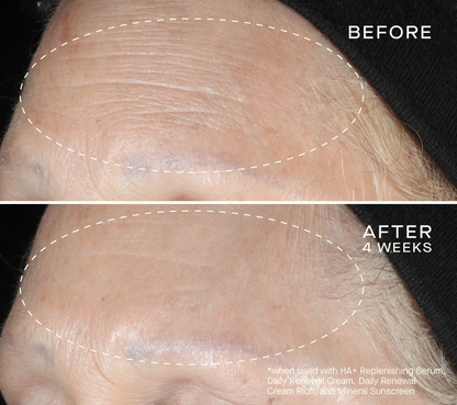 Advanced Regenerative Serum 30mL