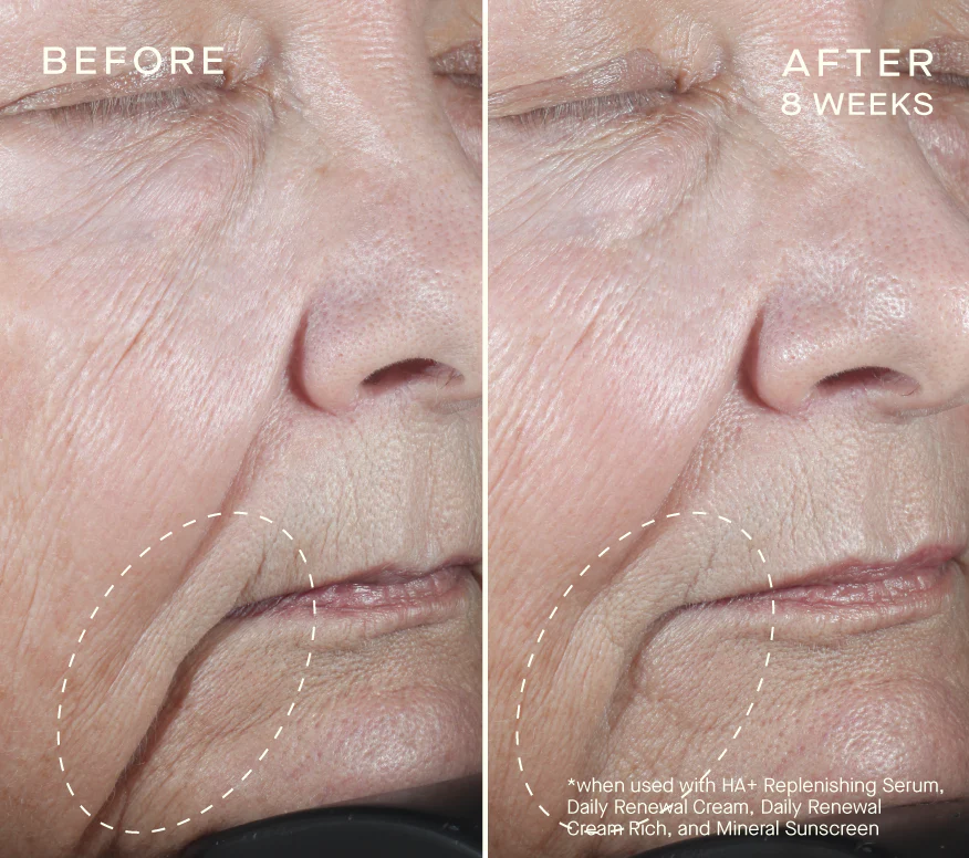 Advanced Regenerative Serum 30mL