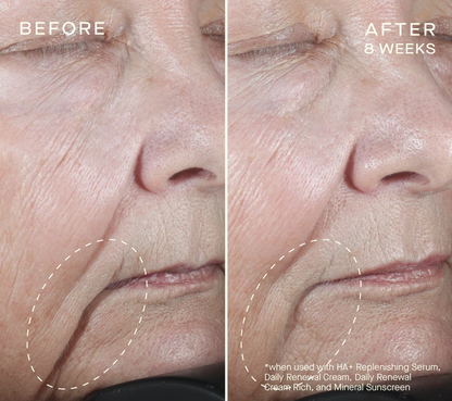 Advanced Regenerative Serum 30mL