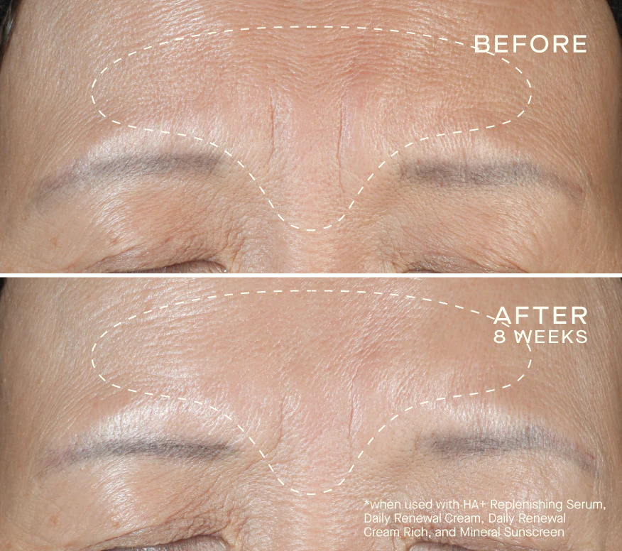Advanced Regenerative Serum 30mL