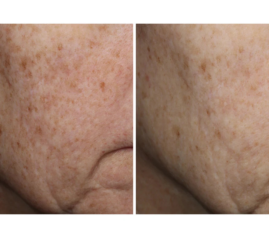 Complexion Brightening Serum
