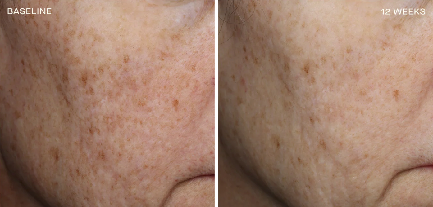 Complexion Brightening Serum 30ML