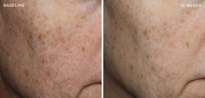 Complexion Brightening Serum 30ML