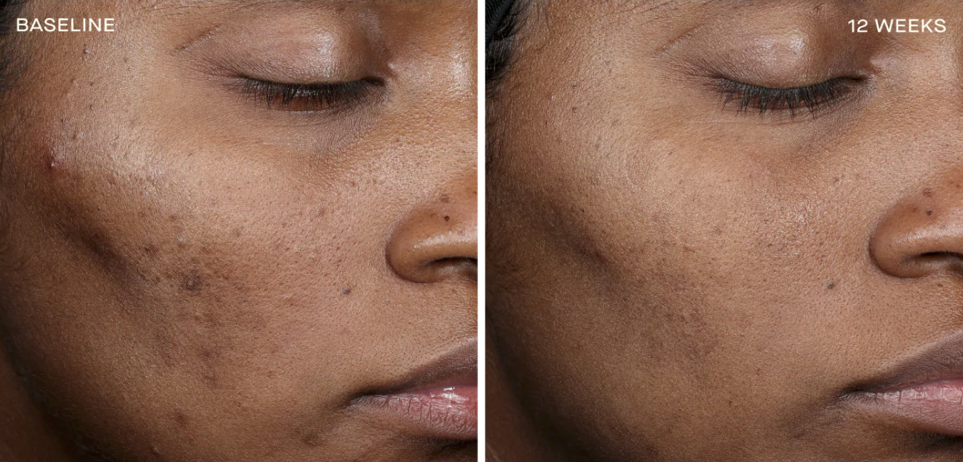 Complexion Brightening Serum 30ML