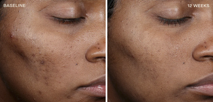 Complexion Brightening Serum 30ML