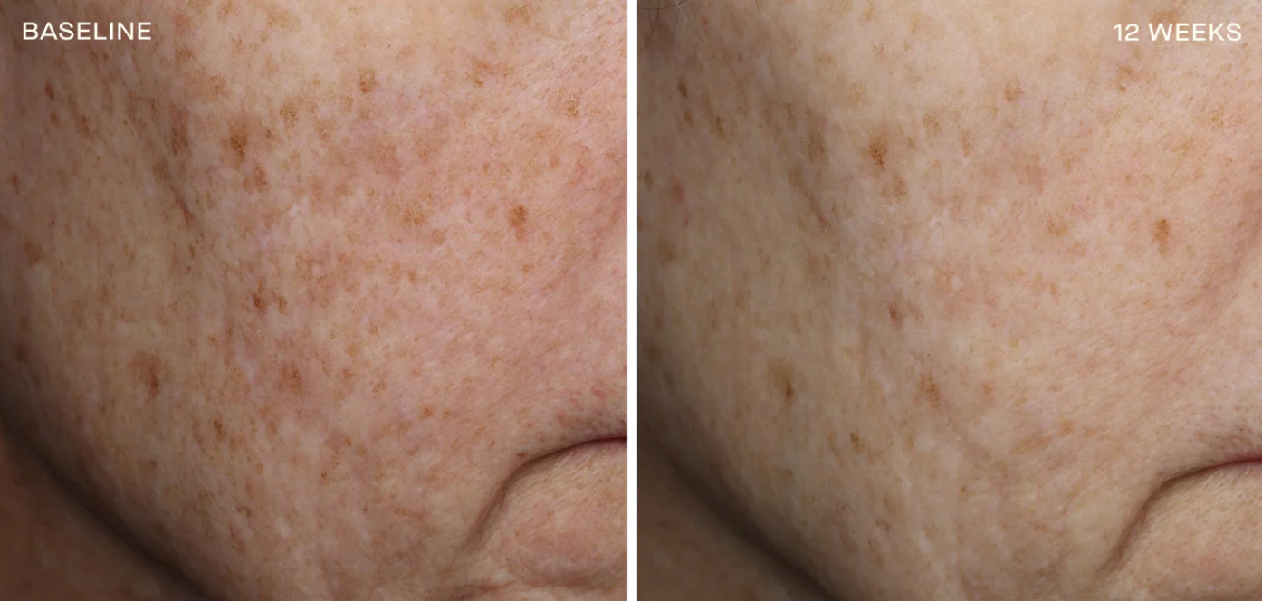 Complexion Brightening Serum 30ML