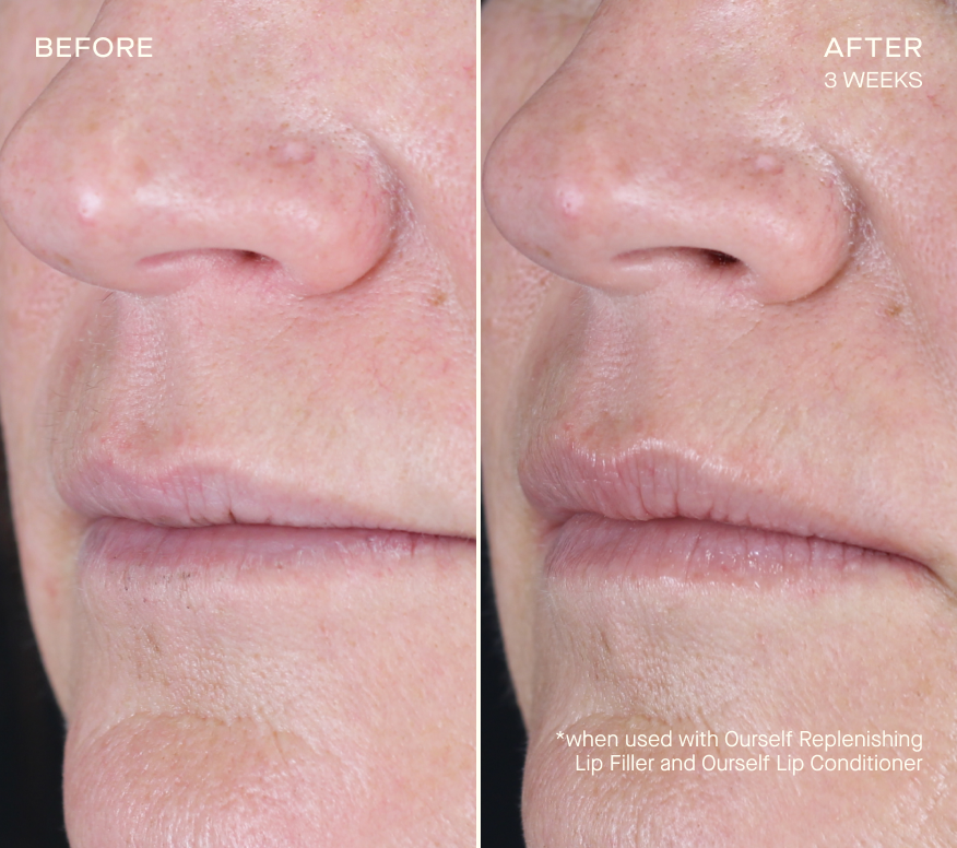 The Lip Plumping and Enhancing Maintenance Regimen